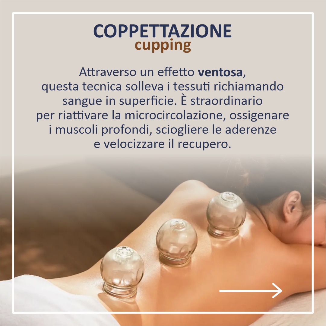 Esempio di applicazione delle coppette sulla schiena
